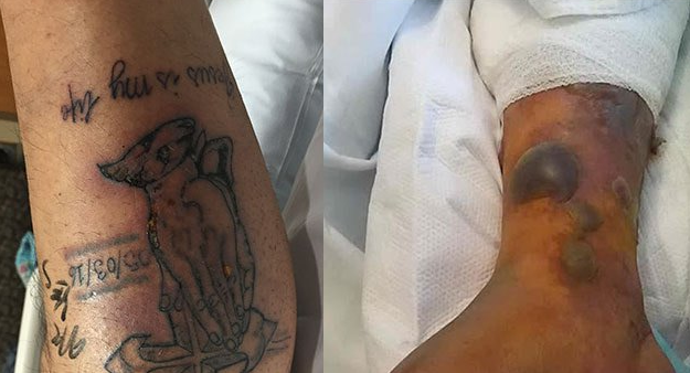 New Tattoo Warnings: Man Dies From Flesh-Eating Bacteria After Swimming In Gulf Of Mexico With New Ink